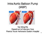 Intra Aortic Balloon Pump (IABP) PowerPoint Presentation