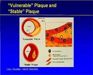 Myocardial infarction PowerPoint Presentation