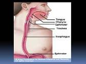 Dysphagia-Causes and Management