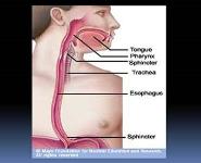 Dysphagia-Causes and Management PowerPoint Presentation Notes