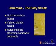 Atheroma PowerPoint Presentation