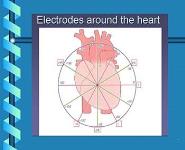 Making ECGs Easy PowerPoint Presentation Notes
