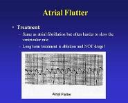 Supraventricular Tachycardia PowerPoint Presentation Notes