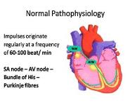 Arrhythmias PowerPoint Presentation Notes