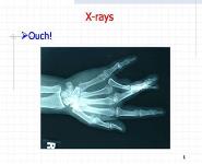 X-rays presentation1 PowerPoint Presentation
