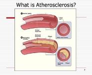 Women and Heart Disease Across the Lifespan PowerPoint Presentation