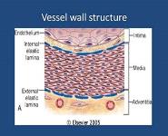 Atherosclerosis PowerPoint Presentation Notes