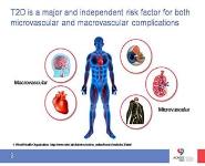 Cardiovascular disease and Type 2 Diabetes PowerPoint Presentation
