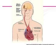 Atrial Fibrillation and Anticoagulation PowerPoint Presentation Notes