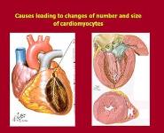 Pathophysiology of Heart Failure PowerPoint Presentation Notes