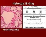Acute Respiratory Distress Syndrome PowerPoint Presentation Notes