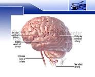 Hemorrhagic stroke PowerPoint Presentation Notes