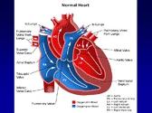 Tetralogy of Fallot