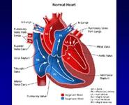 Tetralogy of Fallot PowerPoint Presentation