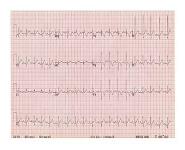 Paediatric Cardiology PowerPoint Presentation Notes