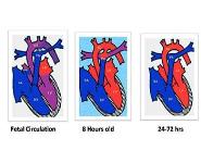 Congenital Heart Disease (CHD) PowerPoint Presentation Notes