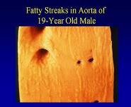 Best Diet for CHD Prevention PowerPoint Presentation Notes