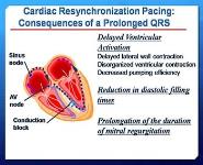 Heart Failure PowerPoint Presentation