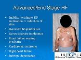 Advanced Therapies in Chronic Heart Failure