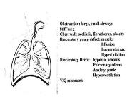 Dyspnea PowerPoint Presentation