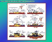 Challenging Issues in Infective Endocarditis PowerPoint Presentation