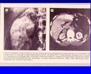 Endocrine Emergencies PowerPoint Presentation Notes