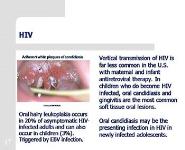 Protecting All Childrens Teeth PowerPoint Presentation Notes