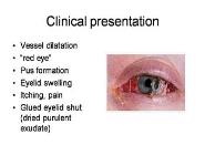 Eye Ear Nose and Throat Infections PowerPoint Presentation
