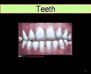 Dental Emergencies and Common Dental Blocks PowerPoint Presentation