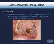 Evidence-Based Management Strategies for Oral Complication from Cancer Treatment PowerPoint Presentation Notes