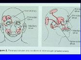 Acute Sinusitis - Diagnosis Management and Complications