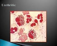 Microbial Flora of Human Body (Normal Flora) PowerPoint Presentation Notes