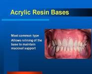 Denture Bases PowerPoint Presentation