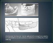 Repairs for RPD PowerPoint Presentation