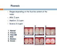 Dental Hard Tissue Discolouration - Etiology and treatment PowerPoint Presentation Notes