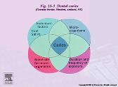 Dental Caries