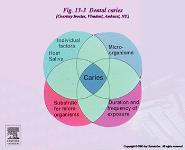 Dental Caries PowerPoint Presentation Notes