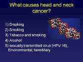 Clinical Management of Head and Neck Cancer