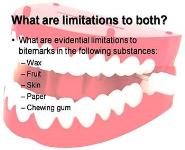 Analysis of Bitemarks PowerPoint Presentation Notes