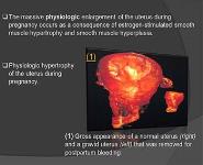 Cellular Adaptations To Stress PowerPoint Presentation
