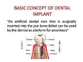 Basic concept of dental implant