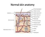 Eczematous skin disorders PowerPoint Presentation