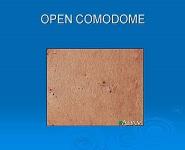 Acne Evaluation and management PowerPoint Presentation Notes