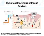 Applying Science to Improve the Individualized Treatment of Patients with Psoriasis PowerPoint Presentation Notes