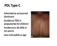 Dermatology in Individuals with SKIN OF COLOR PowerPoint Presentation