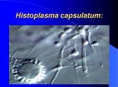 Histoplasma capsulatum