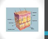 Basics of Pressure Ulcer Prevention and Wound Care PowerPoint Presentation