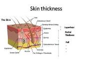 Burns PowerPoint Presentation Notes