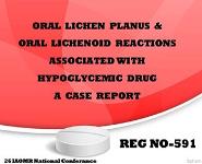 ORAL LICHEN PLANUS PowerPoint Presentation