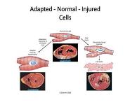 Cell Injury Death Inflammation and Repair PowerPoint Presentation Notes